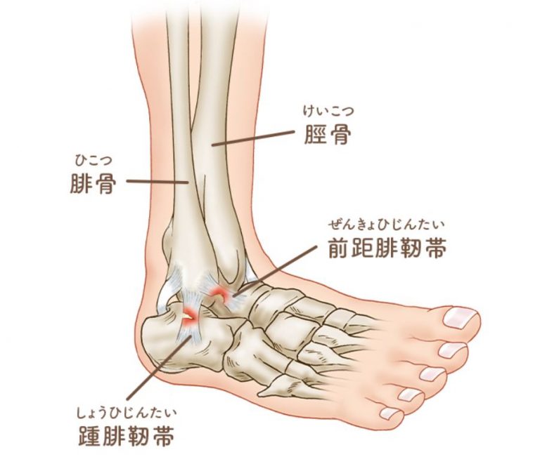 急に足首が痛い